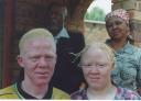 Negros albinos